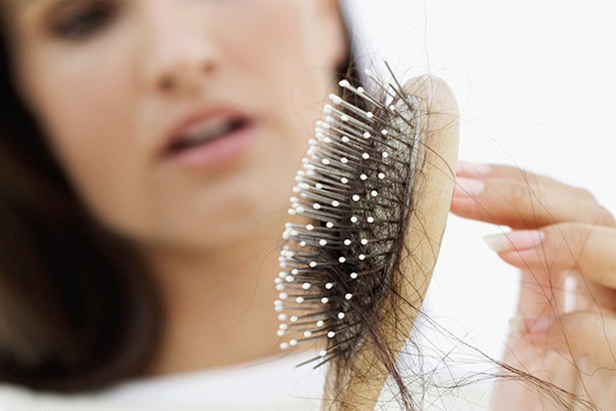 Lao nieuws Previs site Redenen voor haarverlies bij vrouwen. – Toppik haarproducten